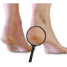 Load image into Gallery viewer, Hypoallergenic Natural Regular Strength Irritation Relief Cream